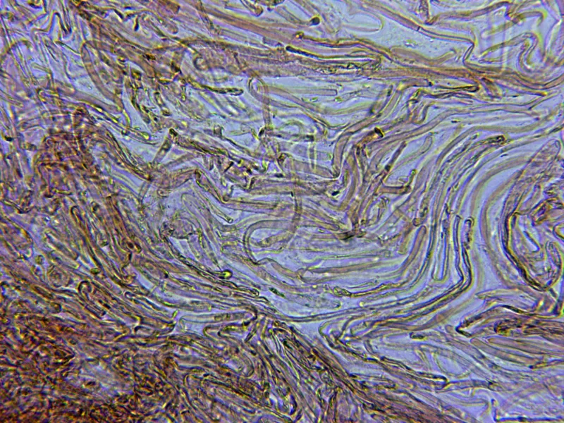 Amanita gemmata 11 - Hifas velo x 400